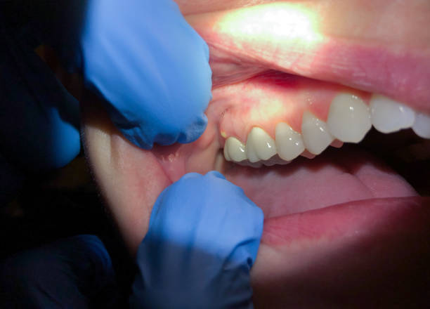 Best Weekend Emergency Dentist in Winter Gardens, CA